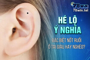 Hé lộ ý nghĩa đặc biệt nốt ruồi ở tai giàu hay nghèo?